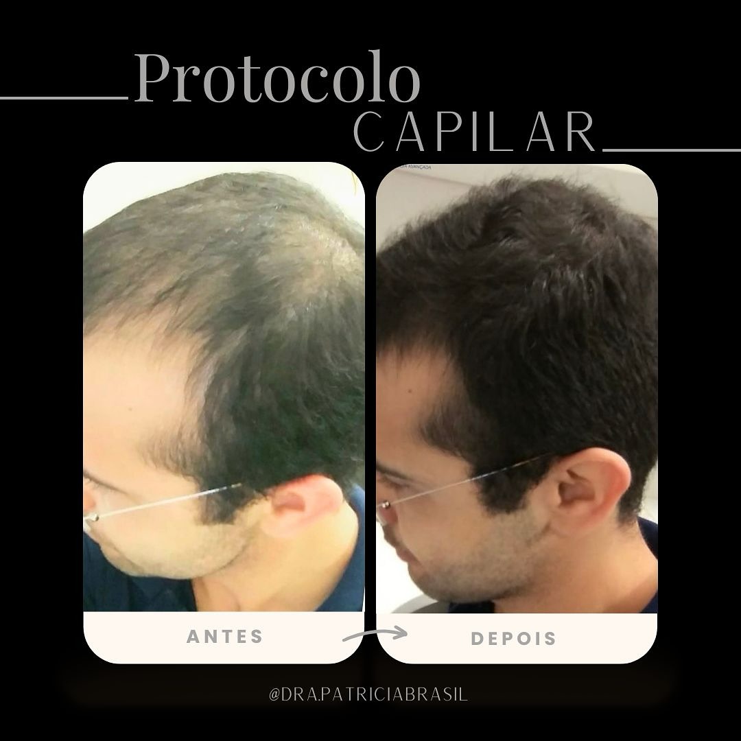 Antes x depois patricia 2