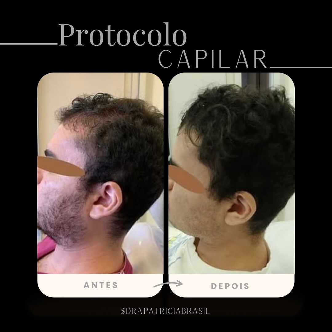 Antes x depois patricia 3